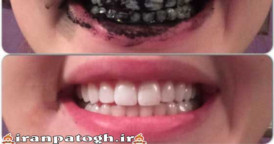 خمیر دندان زغالی اصل 