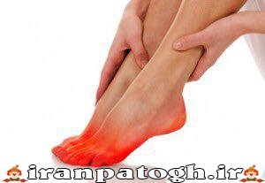 علت سوزش کف پا , ارزیابی دقیق درد و داغ شدن کف پا , داغ شدن کف پا ,درمان سوزش کف پا , ارزیابی دقیق درد و درمان داغ شدن کف پا 