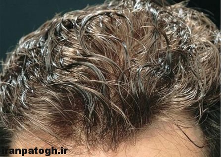 درمان کم پشتی مو ,درمان طبیعی موهای ریخته شده,مغذی پوست کف سر,افزایش رشد موها,افزایش رویش موی سر ,رفع کم پشتی موی سر ,روش داشتن موهایی سالم ,پرپشت شدن موها