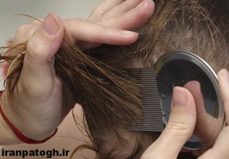 درمان قطعی شپش مو, روش طبیعی برای ریشه کن کردن شپش, از بین بردن شپش با سرکه,رفع طبیعی برای شپش موی سر ,درمان های برای شپش ,از بین بردن شپش سر در خانه