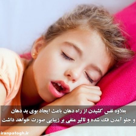 ضرر خوابیدن با دهان باز ,بررسی عوارض نگران کننده خوابیدن با دهان باز,بیماری هایی در پی خوابیدن با دهان باز,,خوابیدن با دهان باز,رفع خوابیدن با دهان باز