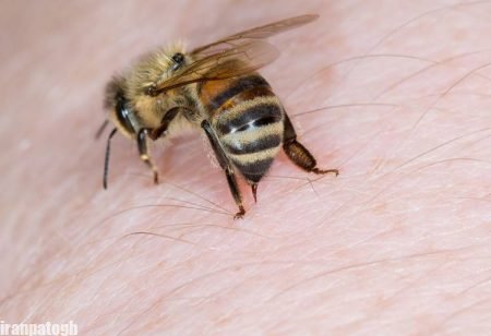 درمان‌های خانگی برای نیش زنبور