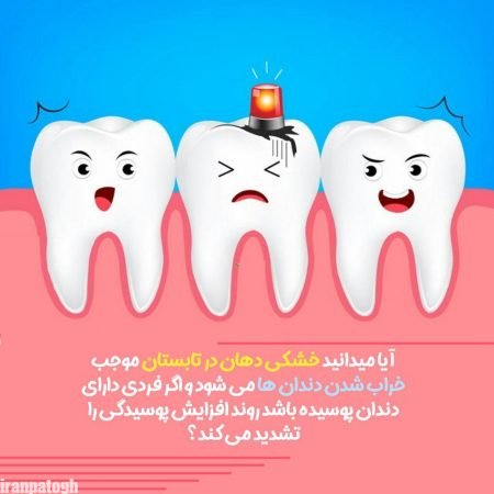 خشکی دهان موجب پوسیدگی دندان
